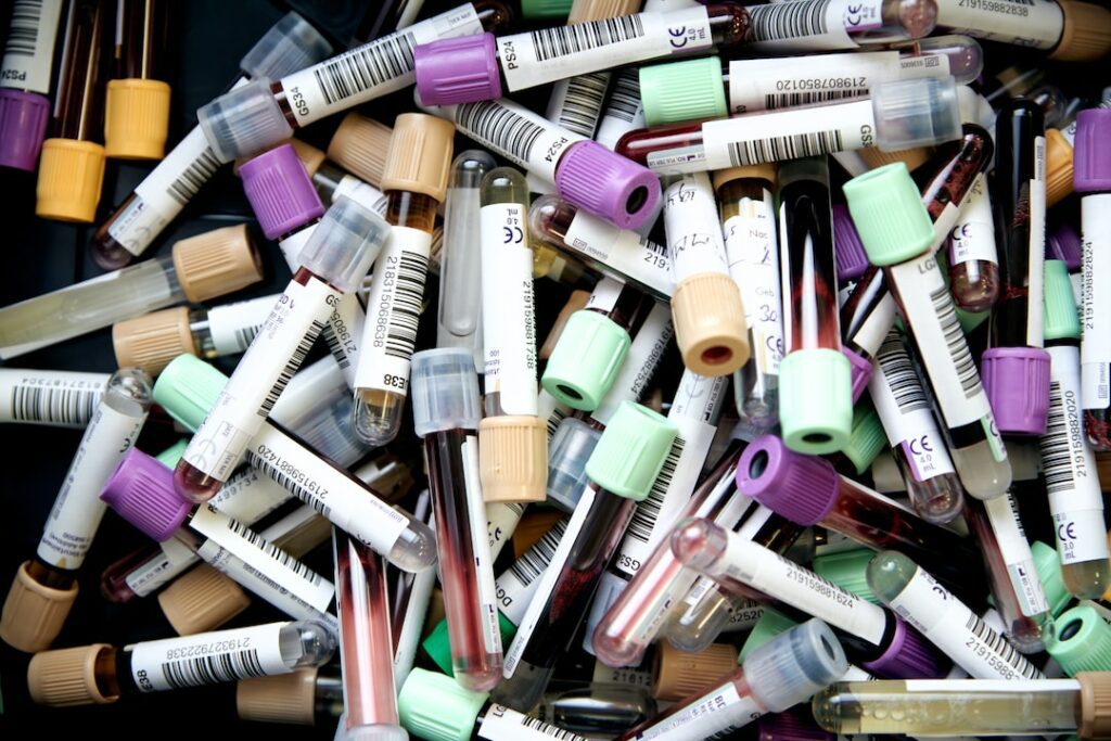 Blood vials blood test tubes with blood